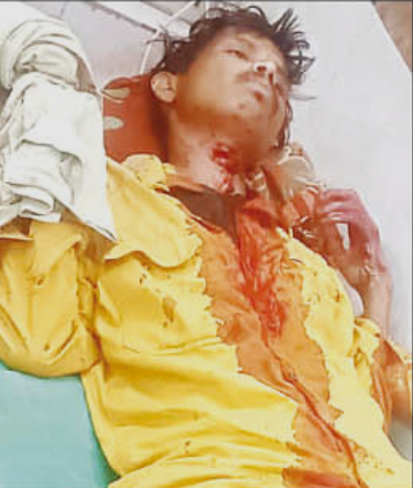 Ambikapur News : युवक ने अपना ही गला रेत लिया, 4 घंटे चला ऑपरेशन , अंबिकापुर शहर से लगे ग्राम बधियाचुंआ का मामला